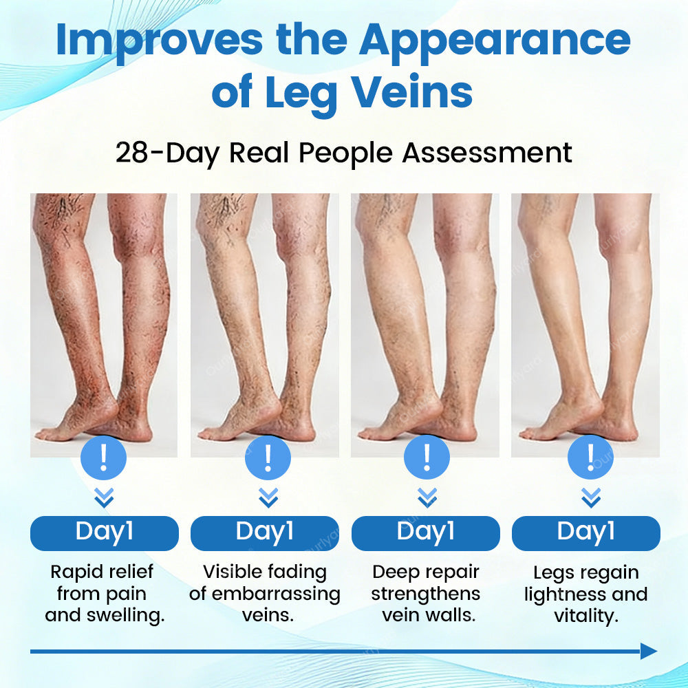 ✅Ourlyard® VascuCare Vein Healing Spray(Designed for Varicose veins, Spider veins, Deep vein Thrombosis, Chronic venous insufficiency, Venous ulcers, Thrombophlebitis and other venous issues)