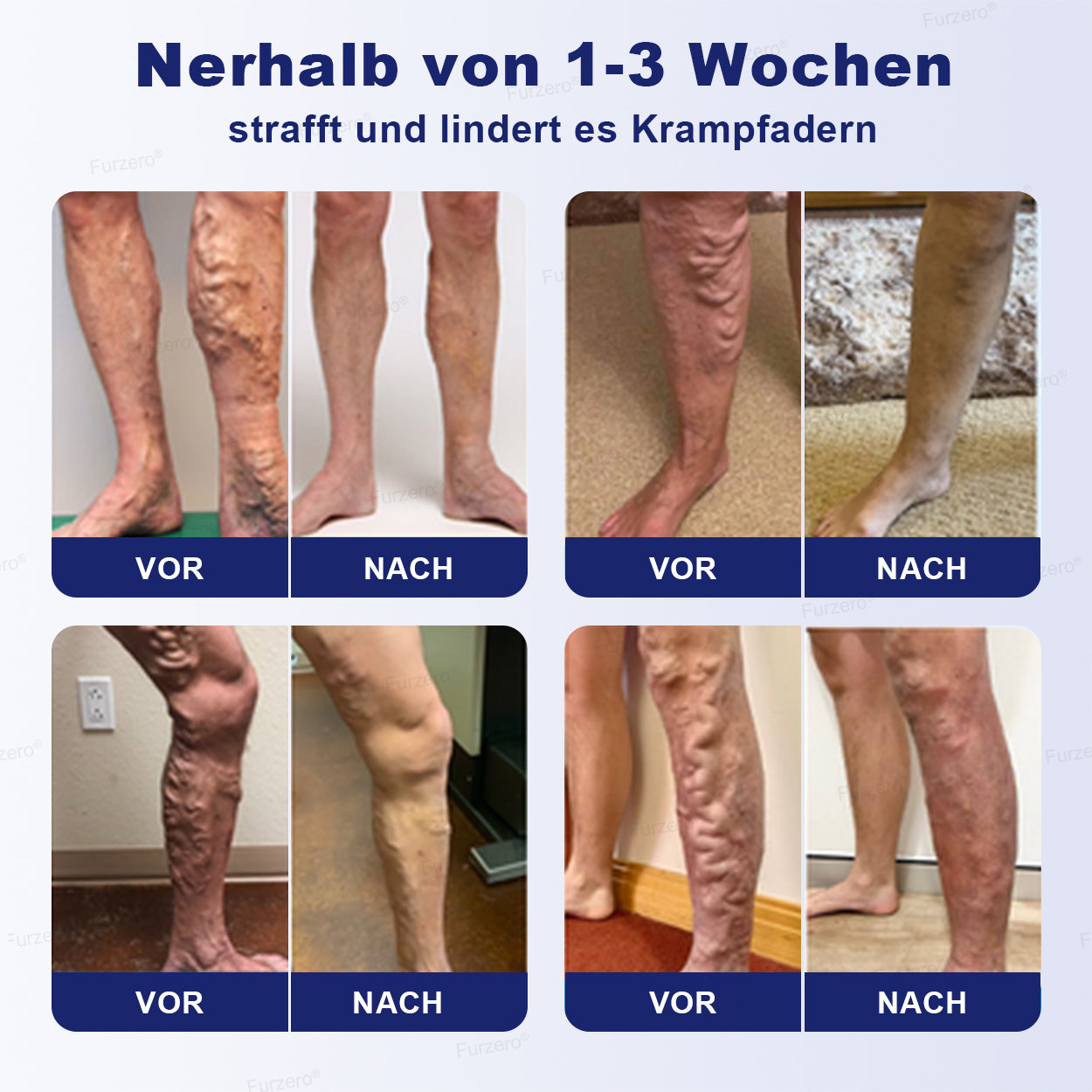 🔥Hergestellt & Versand aus Deutschland🌿Furzero® VeinFreedom Kräuter-Spray - Mikrosprüh-Therapie