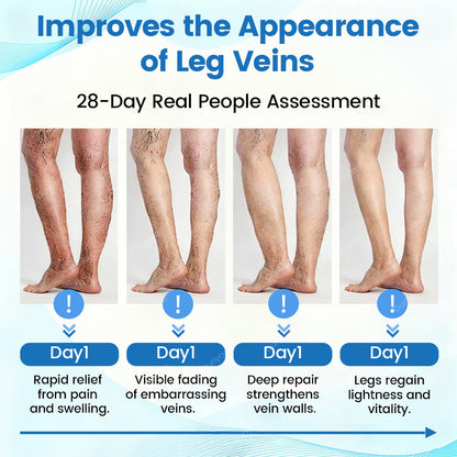 ✅Ourlyard® VascuCare Vein Healing Spray(Designed for Varicose veins, Spider veins, Deep vein Thrombosis, Chronic venous insufficiency, Venous ulcers, Thrombophlebitis and other venous issues)